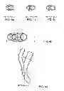 Fig. 07 - Arterial device, system and method for removing embolic debris