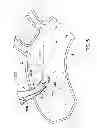 Fig. 08 - Arterial device, system and method for removing embolic debris