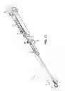 Fig. 02 - Device for removing kidney stones