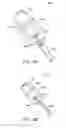 Fig. 16 - Method for removing kidney stones