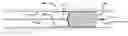 Fig. 01 - DEVICES FOR REMOVING VESSEL OCCLUSIONS