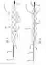 Fig. 02 - DEVICES FOR REMOVING VESSEL OCCLUSIONS