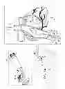 Fig. 02 - Fossa ovalis penetration