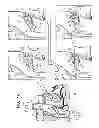 Fig. 04 - Fossa ovalis penetration