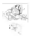 Fig. 07 - Fossa ovalis penetration
