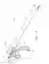 Fig. 02 - Minimally invasive surgical devices and methods