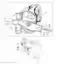 Fig. 07 - Fossa ovalis penetration using probing elements