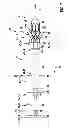 Fig. 06 - INSERTION DEVICE, IN PARTICULAR A CATHETER, FOR INSERTING A MEDICAL HYBRID IMPLANT, AND ALSO MEDICAL HYBRID IMPLANT TO BE INSERTED BY MEANS OF AN INSERTION DEVICE