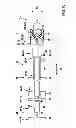 Fig. 09 - INSERTION DEVICE, IN PARTICULAR A CATHETER, FOR INSERTING A MEDICAL HYBRID IMPLANT, AND ALSO MEDICAL HYBRID IMPLANT TO BE INSERTED BY MEANS OF AN INSERTION DEVICE