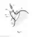 Fig. 08 - Bariatric device and method