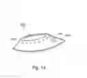 Fig. 15 - Bariatric device and method