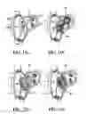 Fig. 07 - ATRIAL SEPTAL OCCLUDER DEVICE AND METHOD