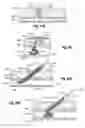 Fig. 37 - Closure system and methods of use