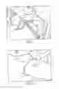 Fig. 08 - Pelvic cable solution