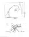 Fig. 09 - Pelvic cable solution