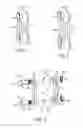 Fig. 02 - INTERSEGMENTAL MOTION PRESERVATION SYSTEM FOR USE IN THE SPINE AND METHODS FOR USE THEREOF