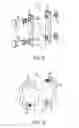 Fig. 05 - INTERSEGMENTAL MOTION PRESERVATION SYSTEM FOR USE IN THE SPINE AND METHODS FOR USE THEREOF