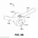 Fig. 09 - Adjustable-angle spinal fixation element