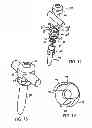Fig. 10 - Polyaxial screw