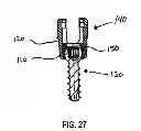 Fig. 14 - Polyaxial screw