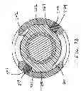 Fig. 20 - Polyaxial screw