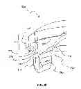 Fig. 24 - Polyaxial screw