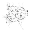 Fig. 50 - Polyaxial screw