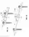 Fig. 02 - Automatic lengthening bone fixation device