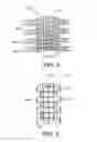 Fig. 06 - Sternum fixation device and method