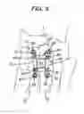 Fig. 06 - Bending tool and method for reshaping a bone plate