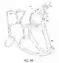 Fig. 02 - Cardiac pacemaker system for usage in combination with an implantable cardioverter-defibrillator