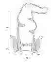 Fig. 02 - System and method for electrical stimulation of anorectal structures to treat anal dysfunction