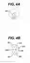 Fig. 06 - Endoprothesis delivery system