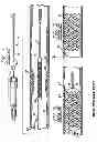 Fig. 02 - Intravascular stent