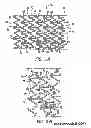 Fig. 04 - Intravascular stent
