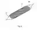 Fig. 09 - Optimized drug-eluting stent assembly