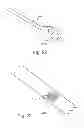 Fig. 22 - Optimized drug-eluting stent assembly