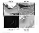 Fig. 08 - Biodegradable vascular grafts