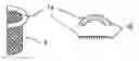 Fig. 01 - MITRAL HEART VALVE PROSTHESIS AND ASSOCIATED DELIVERY CATHETER