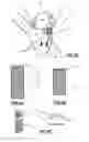 Fig. 05 - MITRAL HEART VALVE PROSTHESIS AND ASSOCIATED DELIVERY CATHETER
