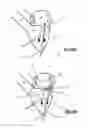 Fig. 06 - MITRAL HEART VALVE PROSTHESIS AND ASSOCIATED DELIVERY CATHETER