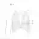 Fig. 02 - Transapical method of delivering prosthetic heart valve