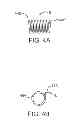 Fig. 04 - Devices and methods for treating valvular regurgitation