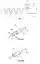 Fig. 07 - Devices and methods for treating valvular regurgitation