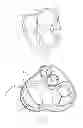 Fig. 08 - Devices and methods for treating valvular regurgitation