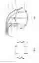 Fig. 03 - Heart valve repair device