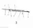 Fig. 05 - Heart valve repair device