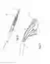 Fig. 10 - Heart valve repair device