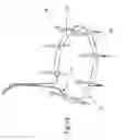 Fig. 13 - Heart valve repair device