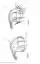 Fig. 15 - Heart valve repair device